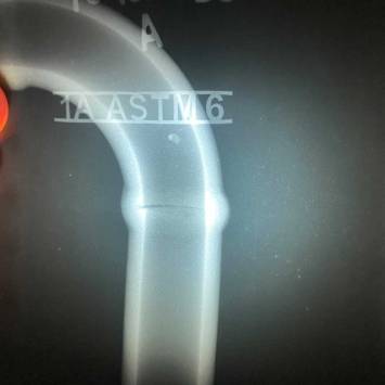 Radiography Testing Service in Nashik